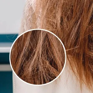 filler-prima (2) (1).jpg