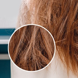 filler-prima (2) (1).jpg