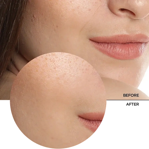 Товар HYALURONIC ACID, Увлажняющая сыворотка с гиалуроновой кислотой 5 % от морщин, REVOX B77 JUST Сыворотки Товар HYALURONIC ACID, Увлажняющая сыворотка с гиалуроновой кислотой 5 % от морщин, REVOX B77 JUST Сыворотки