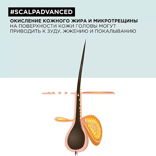 Товар Лореаль Профессионель Шампунь Scalp Advanced регулирующий баланс чувствительной кожи головы, Anti-Discomfort (L'oreal Professionnel, Serie Expert) Шампунь Товар Лореаль Профессионель Шампунь Scalp Advanced регулирующий баланс чувствительной кожи головы, Anti-Discomfort (L'oreal Professionnel, Serie Expert) Шампунь