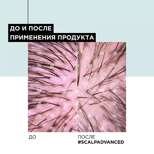 Товар Лореаль Профессионель Шампунь Scalp Advanced регулирующий баланс чувствительной кожи головы, Anti-Discomfort (L'oreal Professionnel, Serie Expert) Шампунь Товар Лореаль Профессионель Шампунь Scalp Advanced регулирующий баланс чувствительной кожи головы, Anti-Discomfort (L'oreal Professionnel, Serie Expert) Шампунь